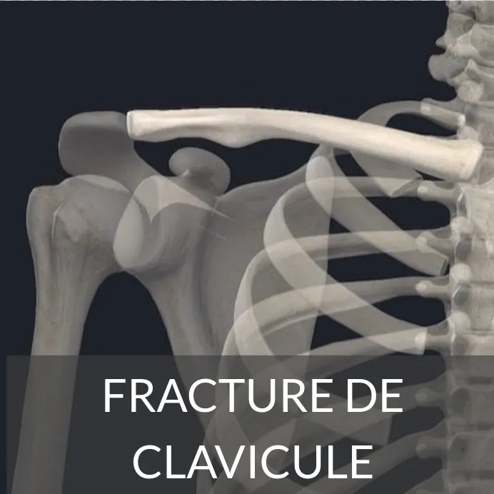 clavicule