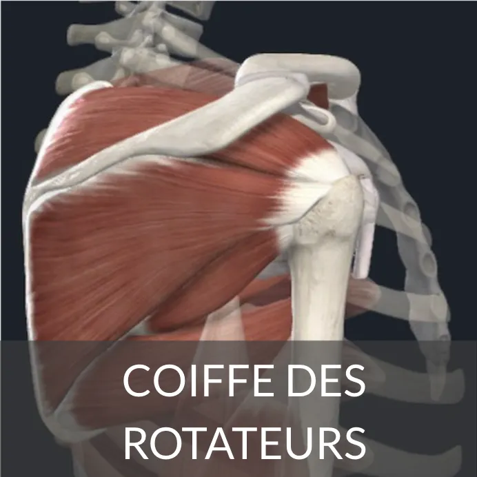 lésion-de-la-coiffe-des-rotateurs