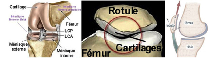 la rotule