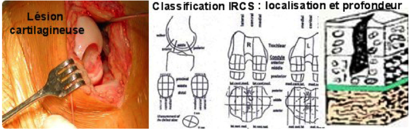 classification IRCS
