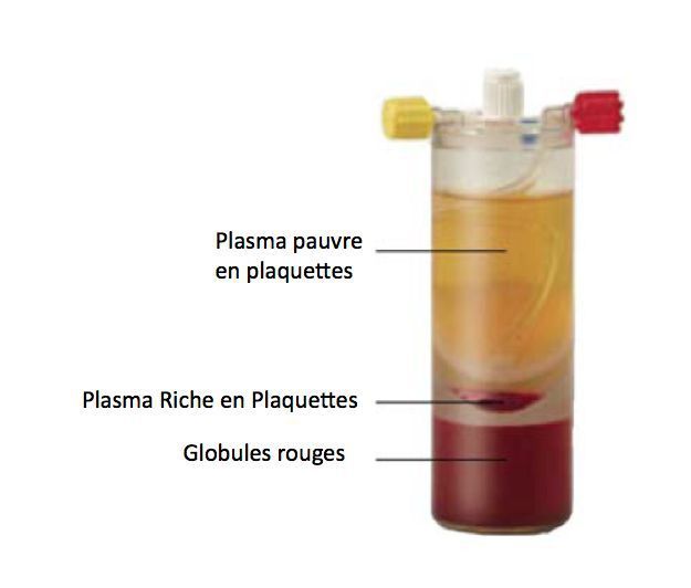 prp