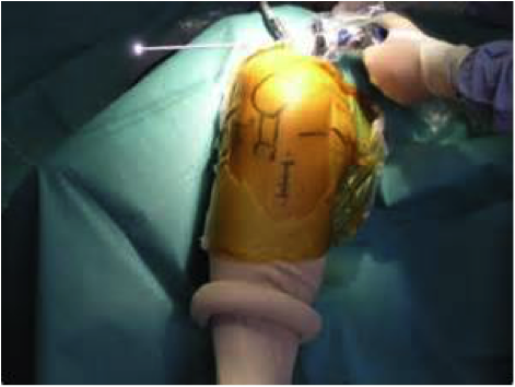 chirurgie didt